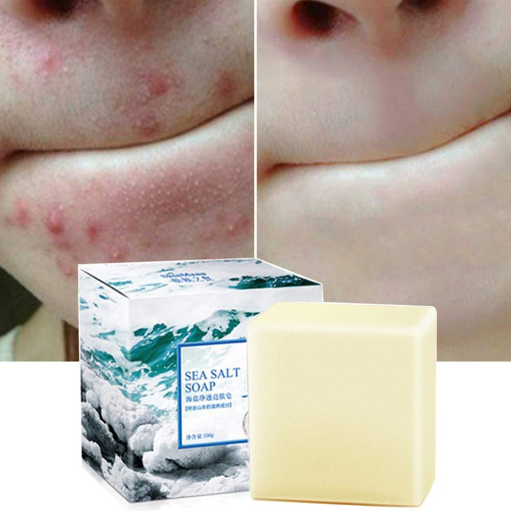 Soap Showdown: Sea Salt Goat's Milk vs. Acne Solutions