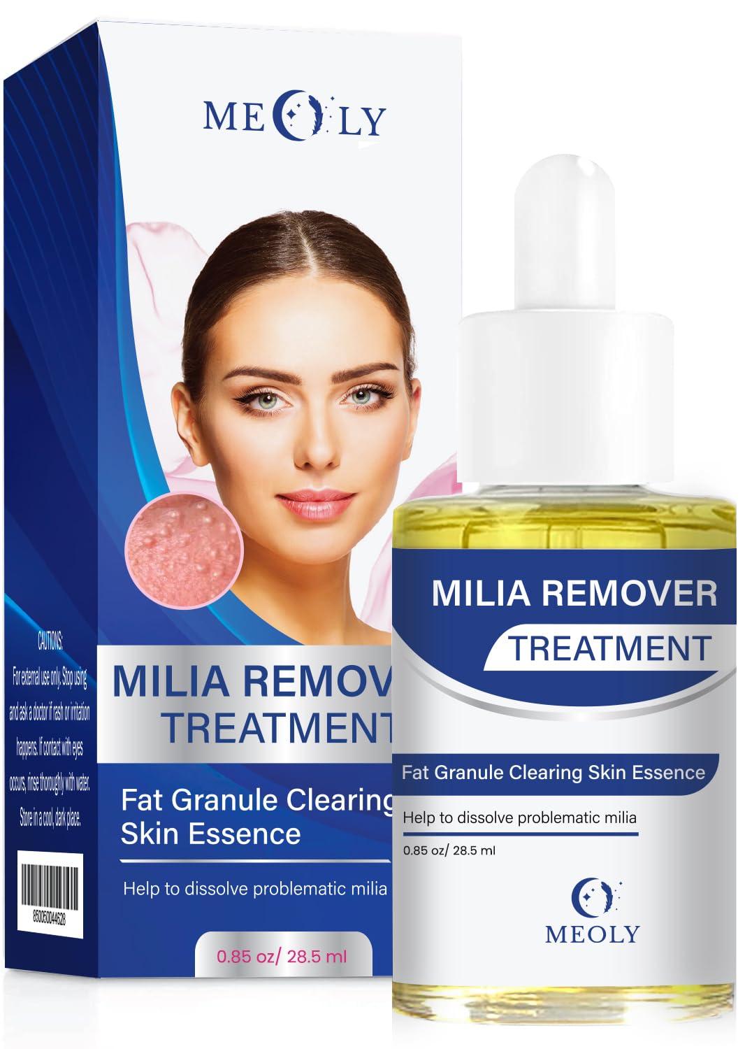 Surprising Milia Treatment Showdown: Extractors vs. Kits